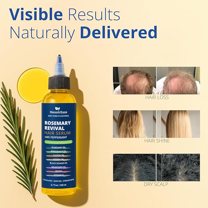 Rosemary, Peppermint & Castor Oil for Hair Growth & Scalp Refresh (6.7 fl oz), Infused with Biotin, Black Sesame, Grapeseed, Jojoba, & Vitamin E Oils for Itchy Scalp, Refreshing & Hydration
